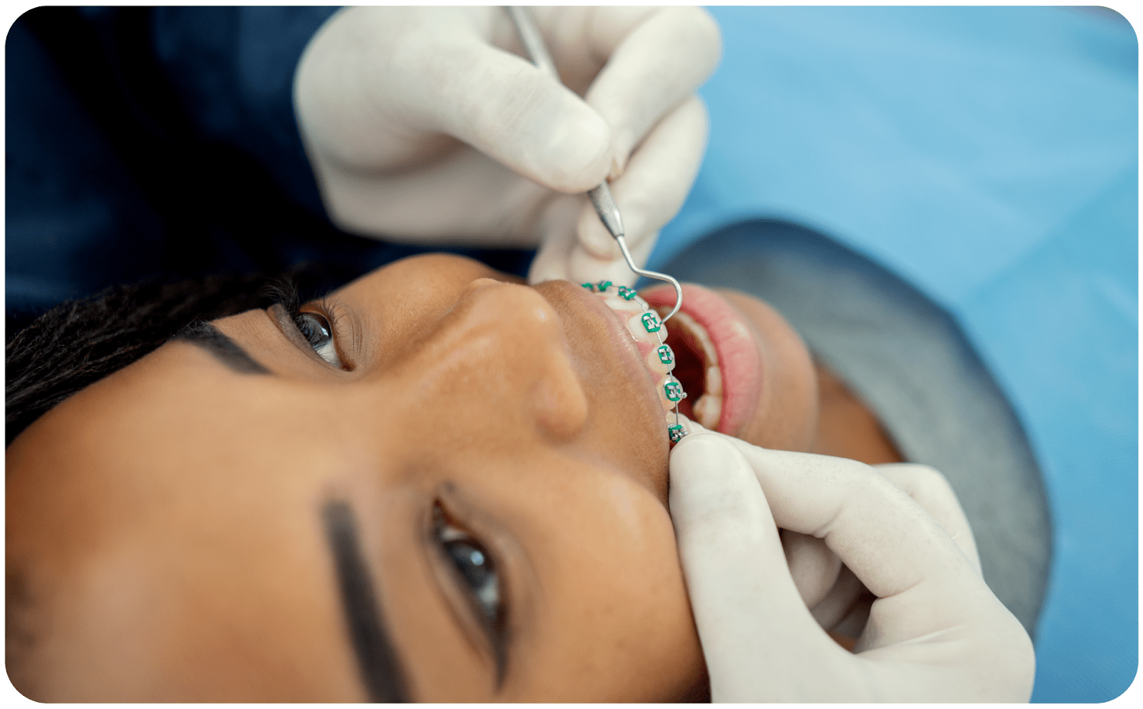 A patient receives braces after learning about braces cost.