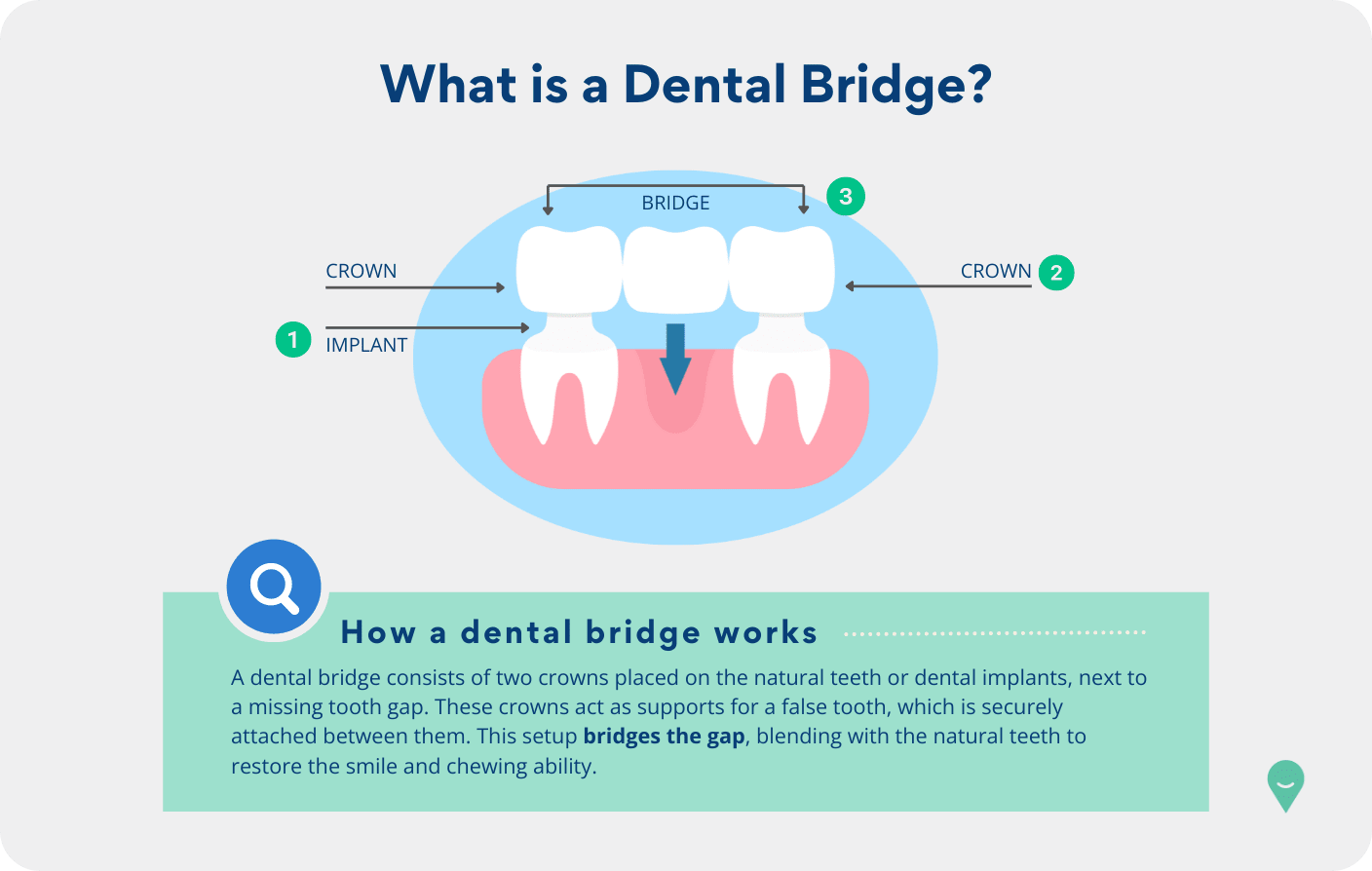 What is a dental bridge